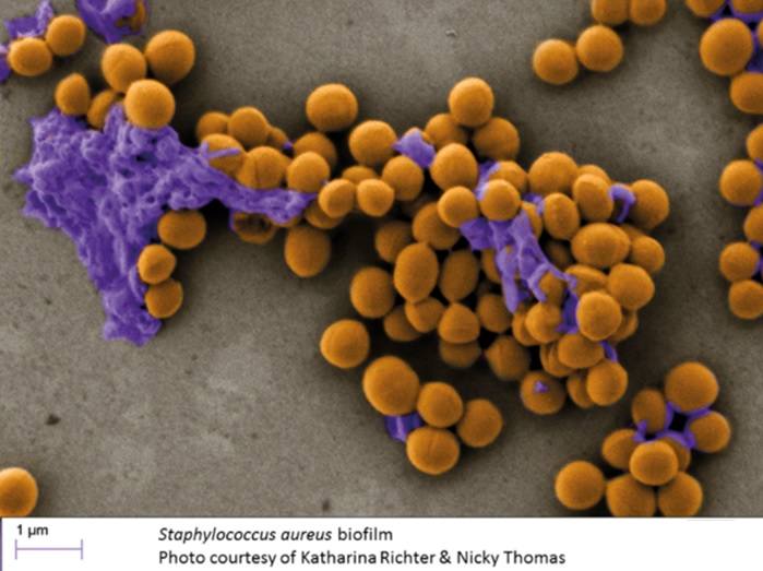Imagen de microscopía electrónica de un biofilm de Staphylococcus aureus